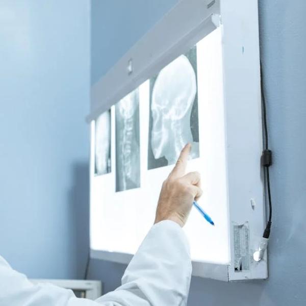 Neurochirurgie